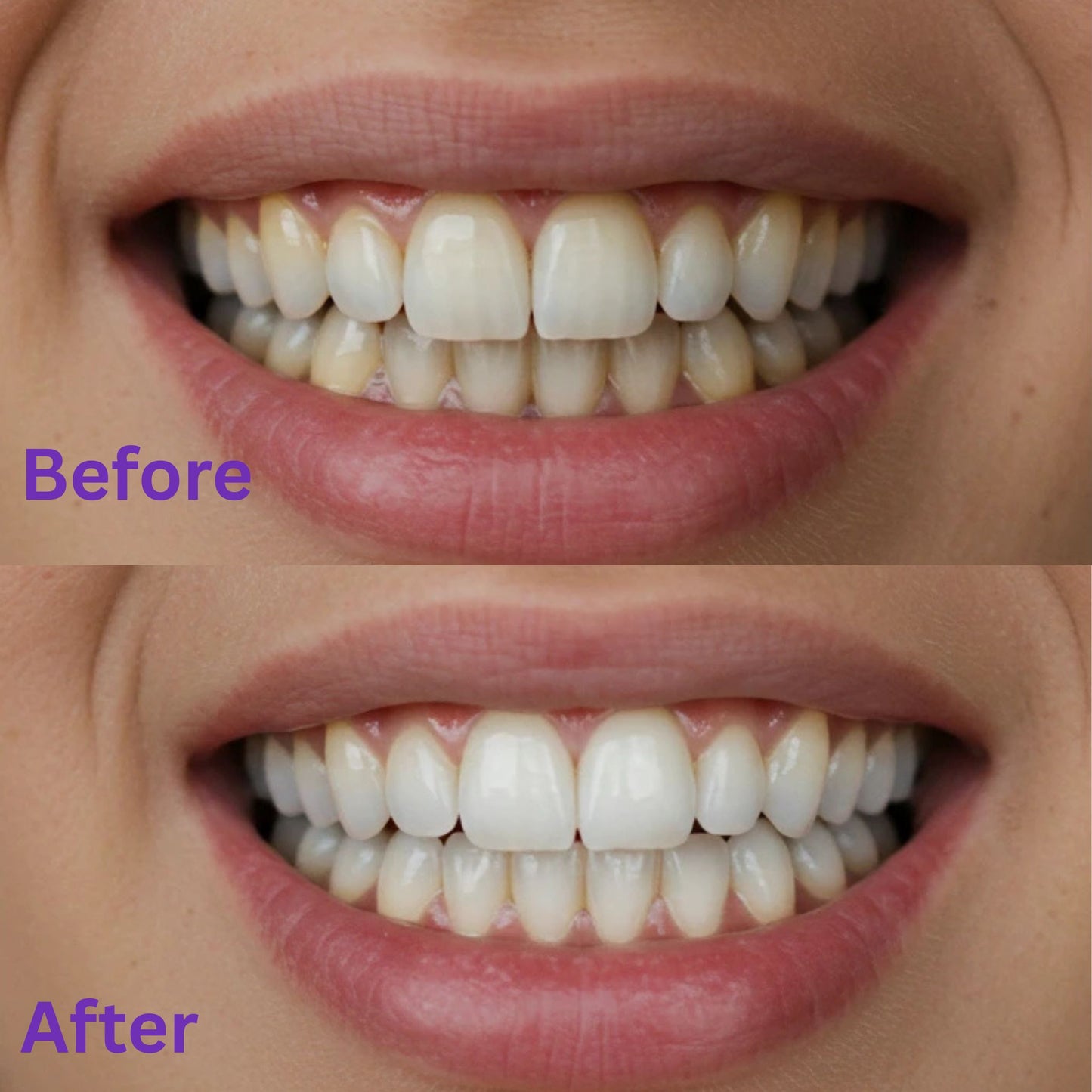 Purelume Whitening Strips