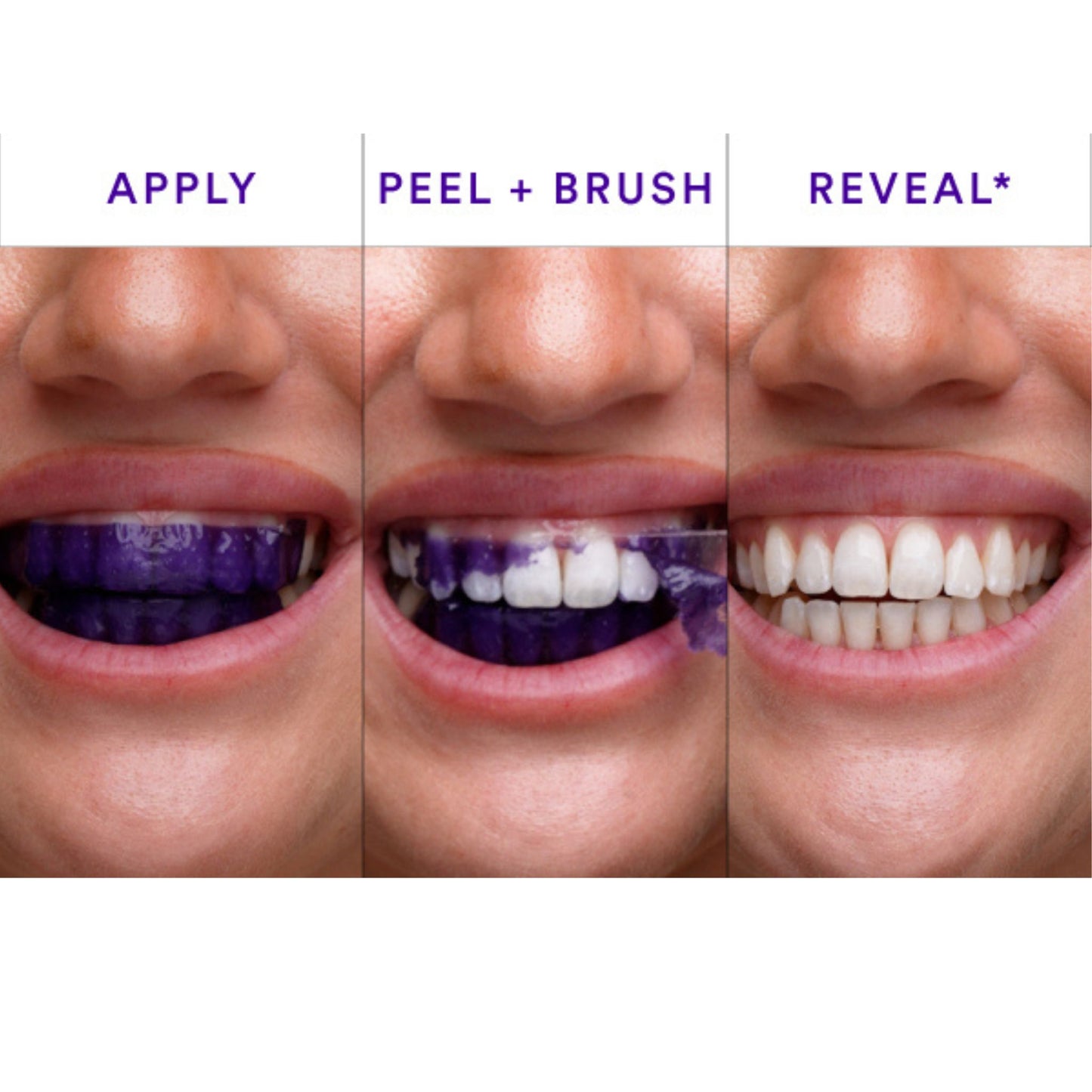 Purelume Whitening Strips