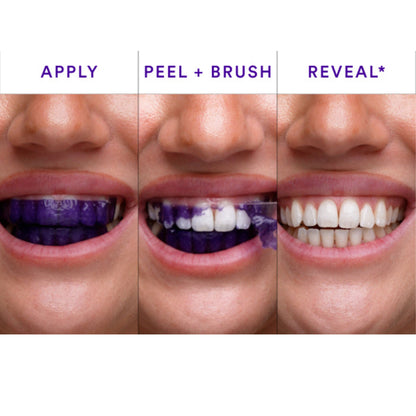 Purelume Whitening Strips